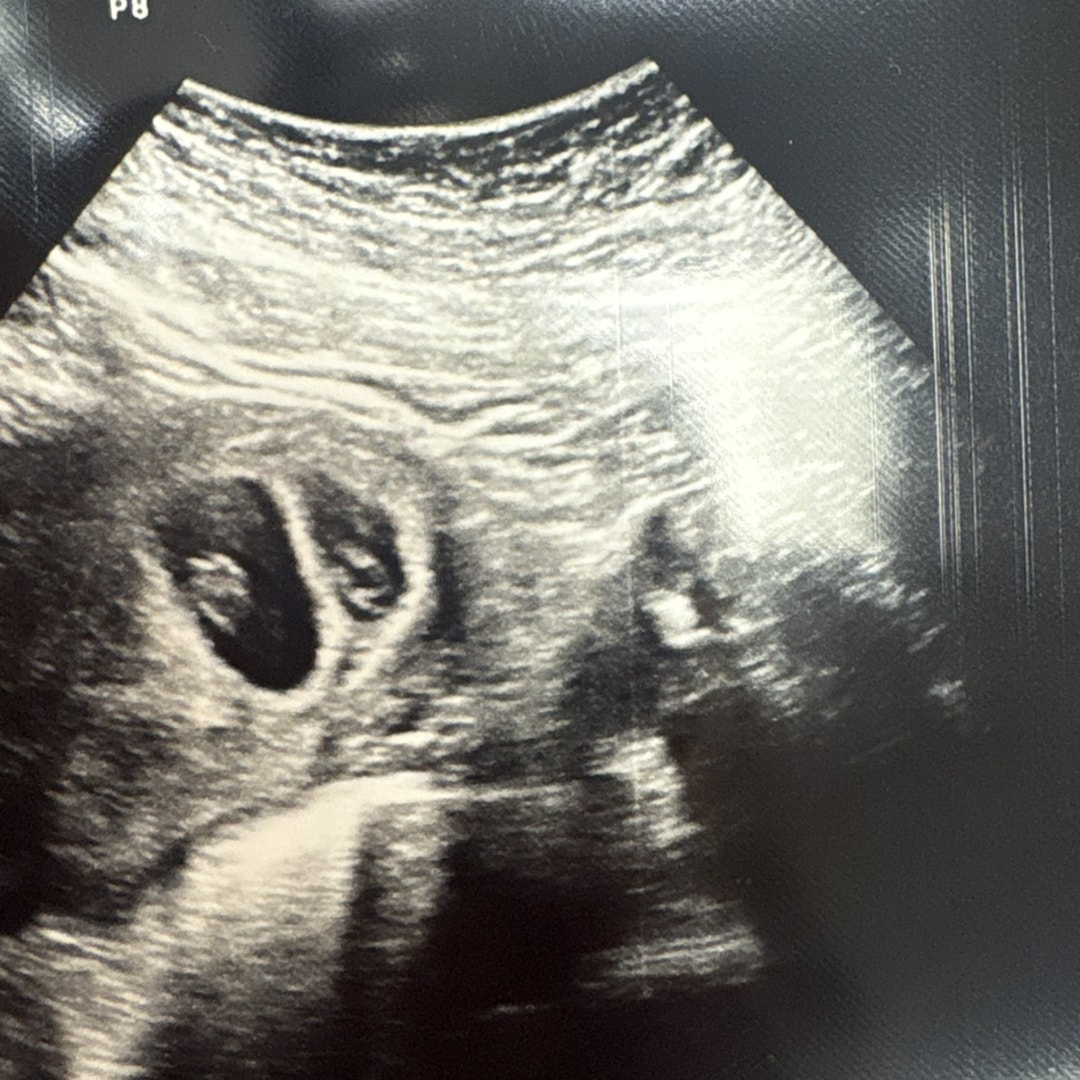 Photo shared by Nichole for their Babylist baby registry.