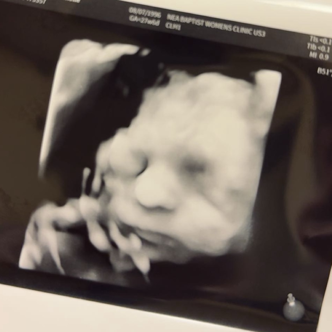 Photo shared by Taylor for their Babylist baby registry.