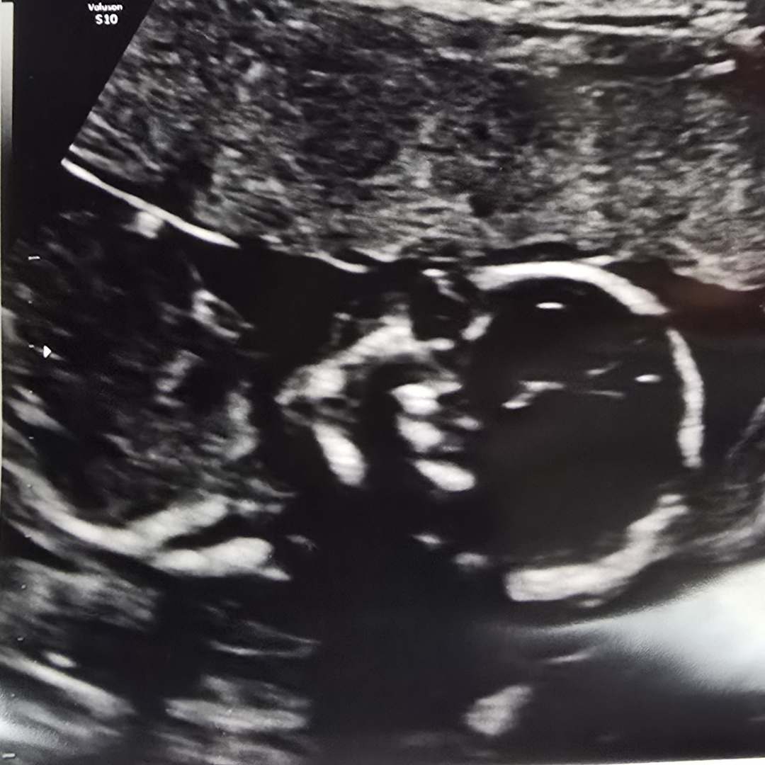 Photo shared by Jacqueline for their Babylist baby registry.