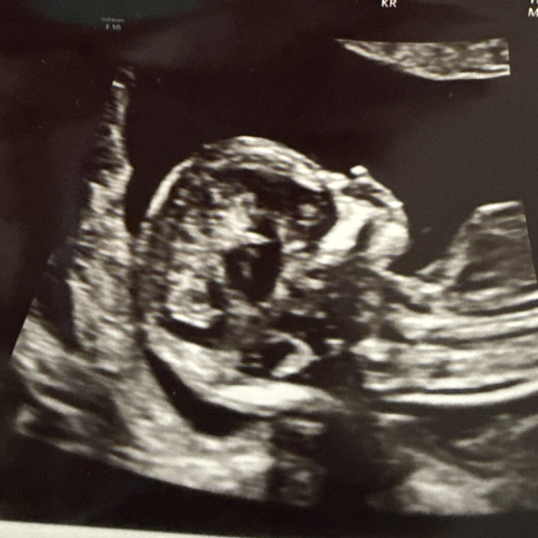 Photo shared by Alicia for their Babylist baby registry.