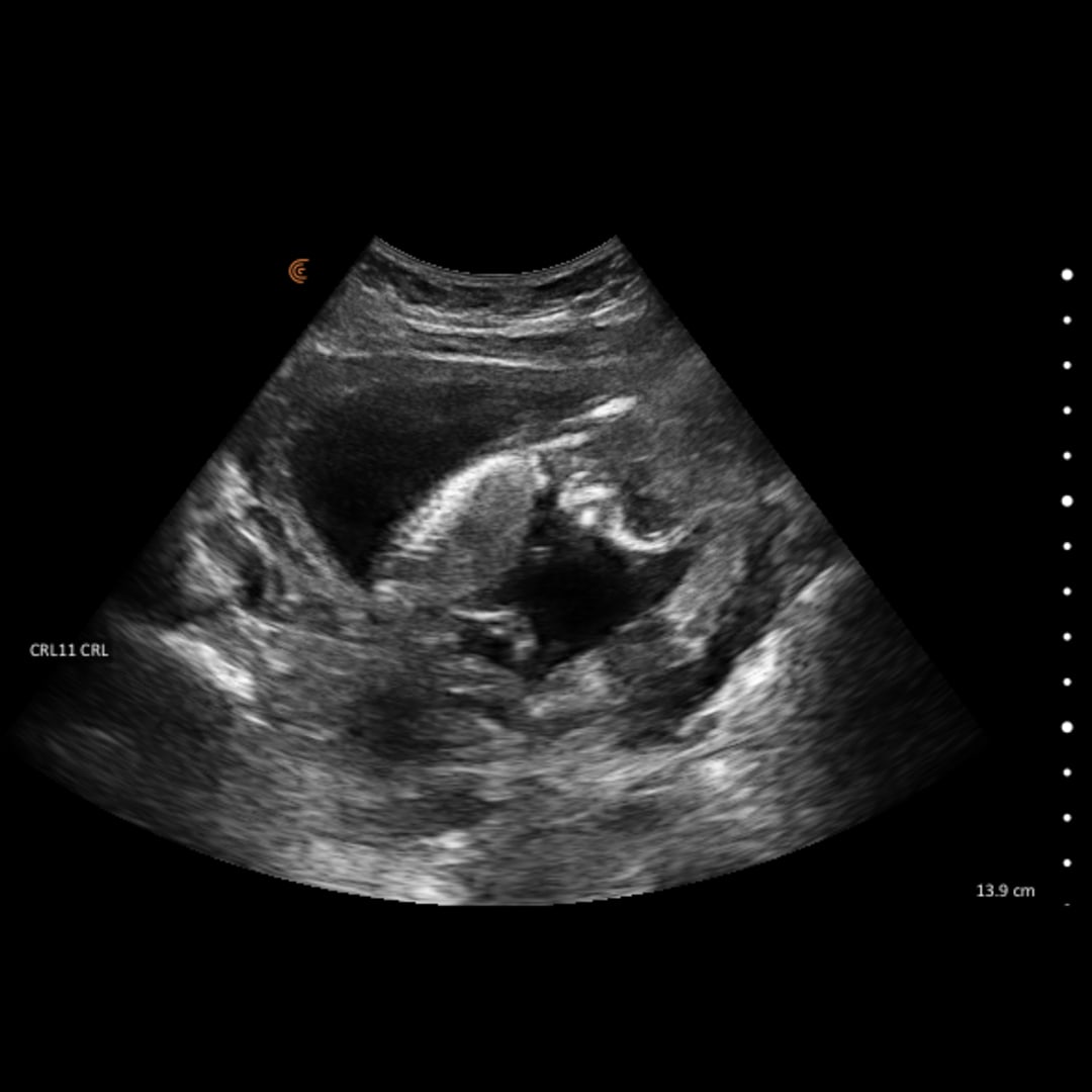 Photo shared by Laken for their Babylist baby registry.