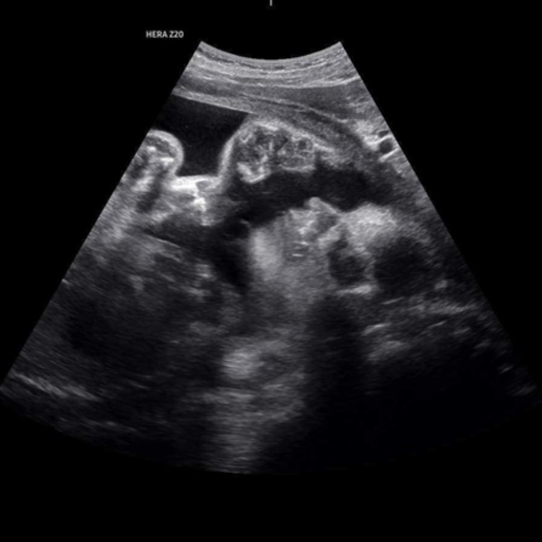 Photo shared by Breanna for their Babylist baby registry.