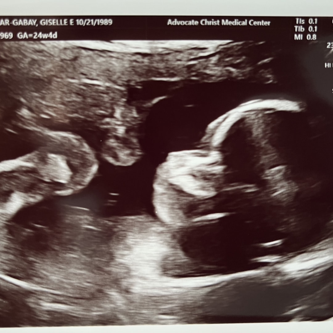 Photo shared by Giselle for their Babylist baby registry.
