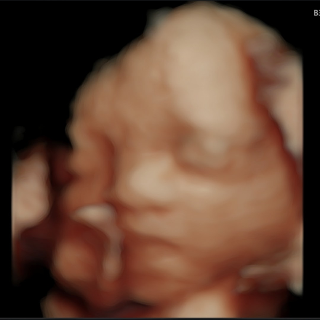 Photo shared by Vanessa for their Babylist baby registry.