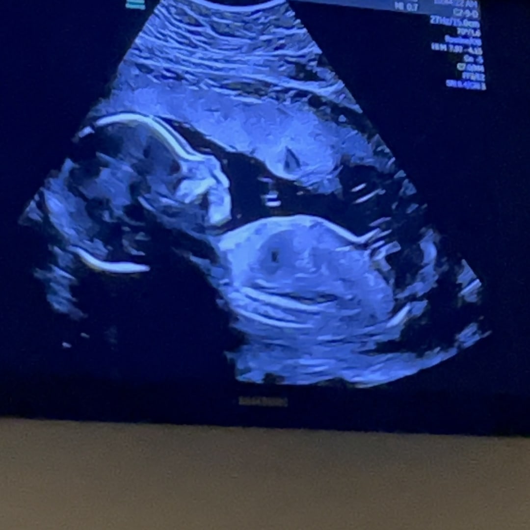 Photo shared by Corinne for their Babylist baby registry.