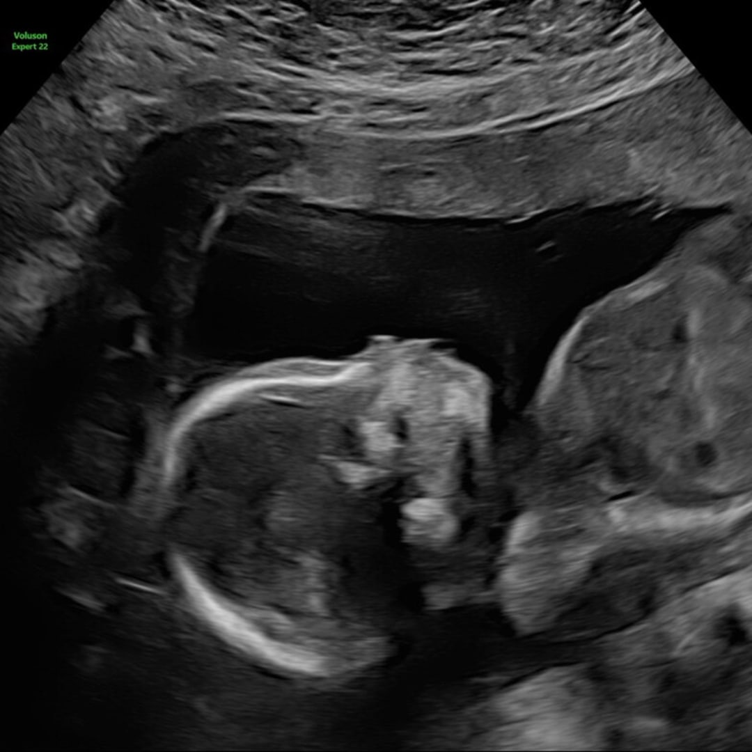 Photo shared by Casey for their Babylist baby registry.