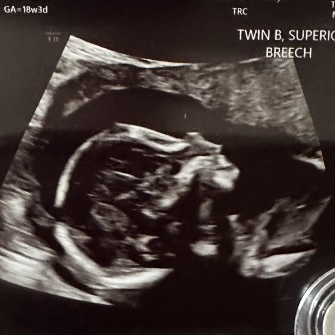 Photo shared by Erica for their Babylist baby registry.