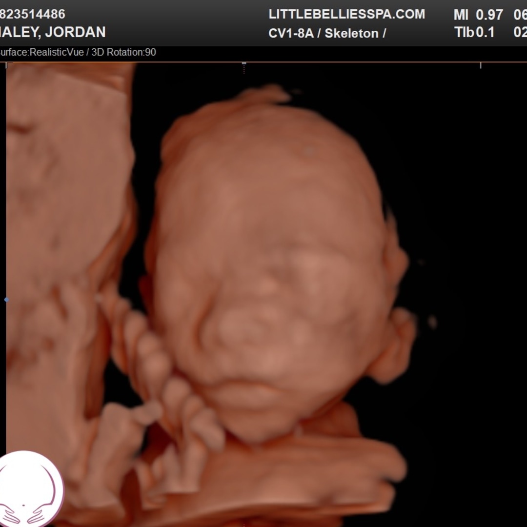 Photo shared by Jordan for their Babylist baby registry.