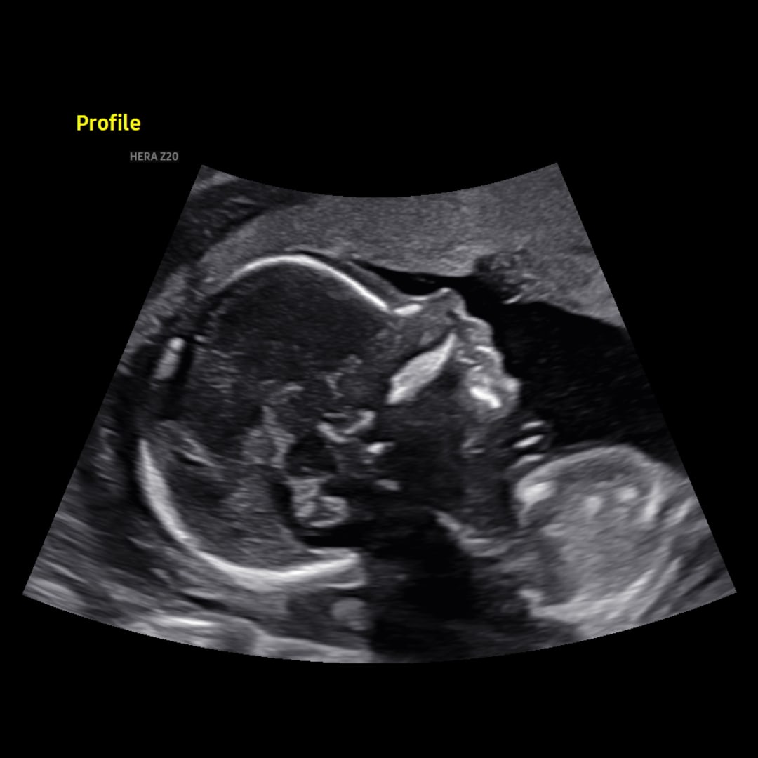 Photo shared by Claudia for their Babylist baby registry.