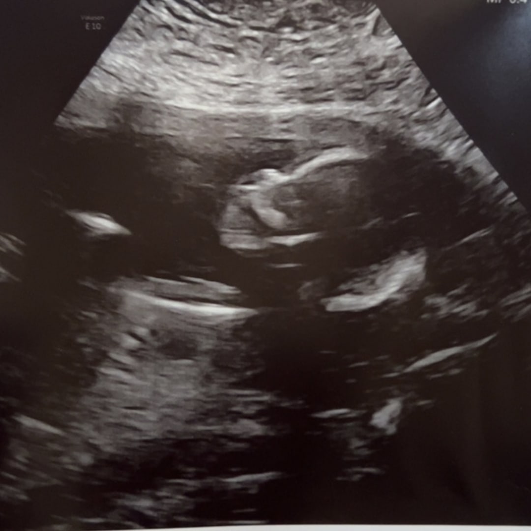 Photo shared by Abby for their Babylist baby registry.