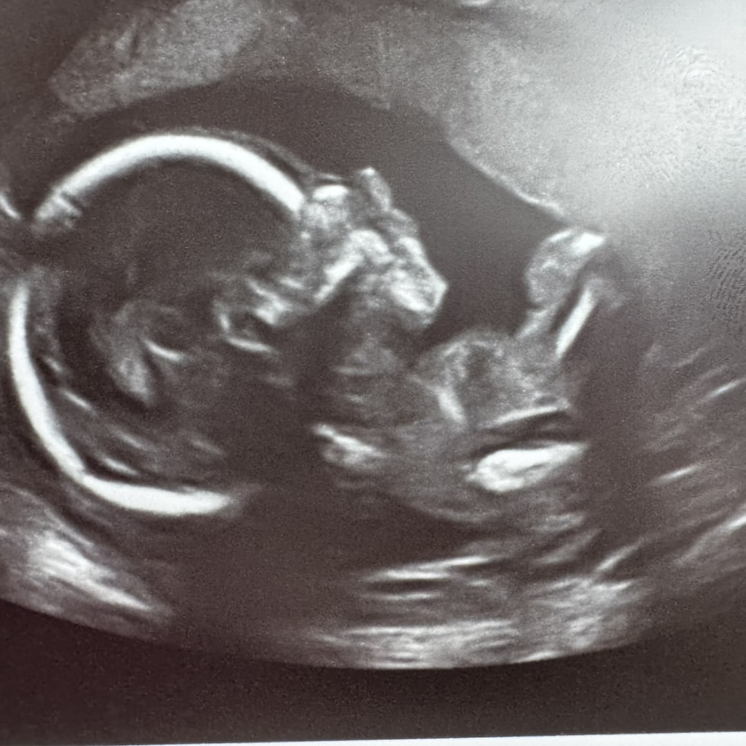 Photo shared by Sara for their Babylist baby registry.