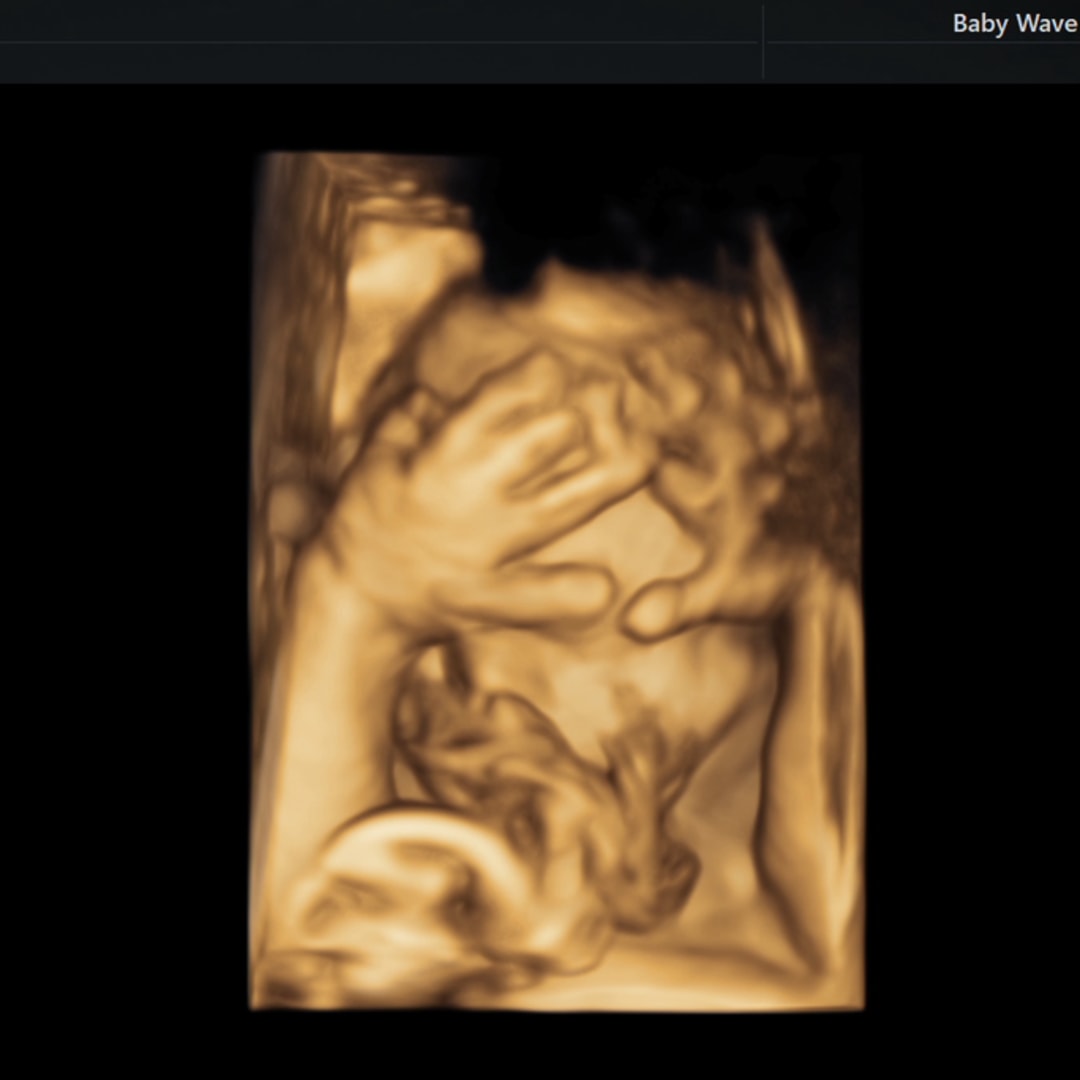 Photo shared by Isabel for their Babylist baby registry.