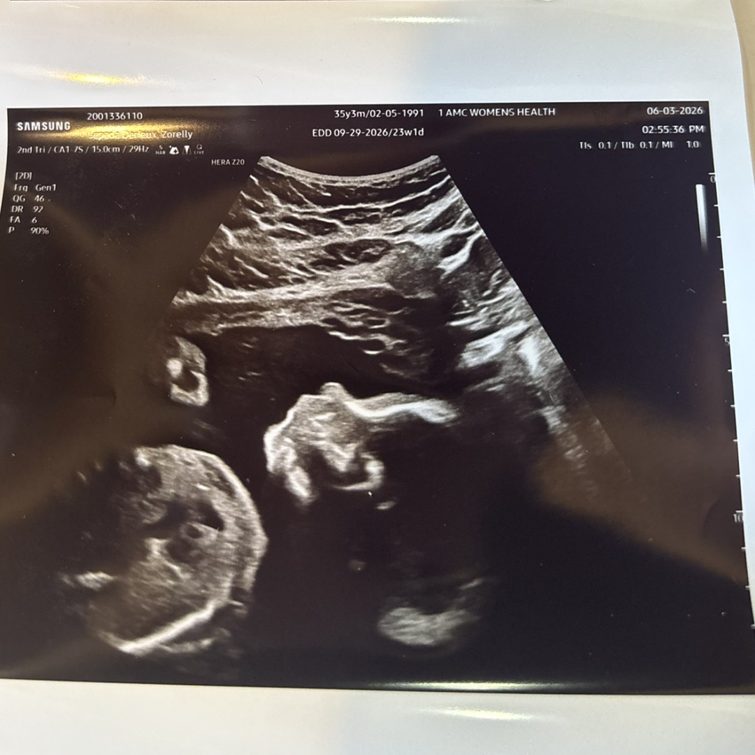 Photo shared by Zorelly for their Babylist baby registry.