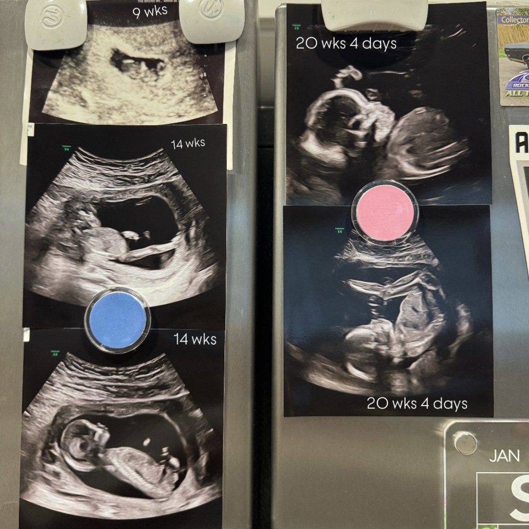 Photo shared by Amirah for their Babylist baby registry.