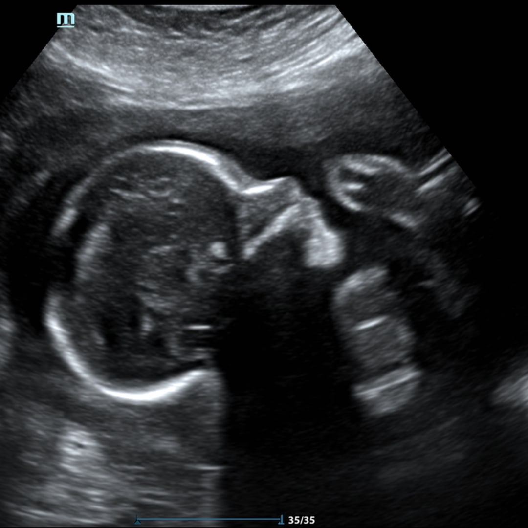Photo shared by Leslie for their Babylist baby registry.