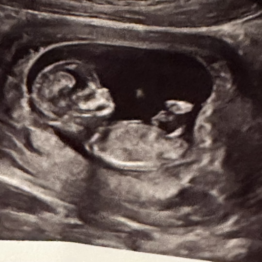 Photo shared by Brittany for their Babylist baby registry.