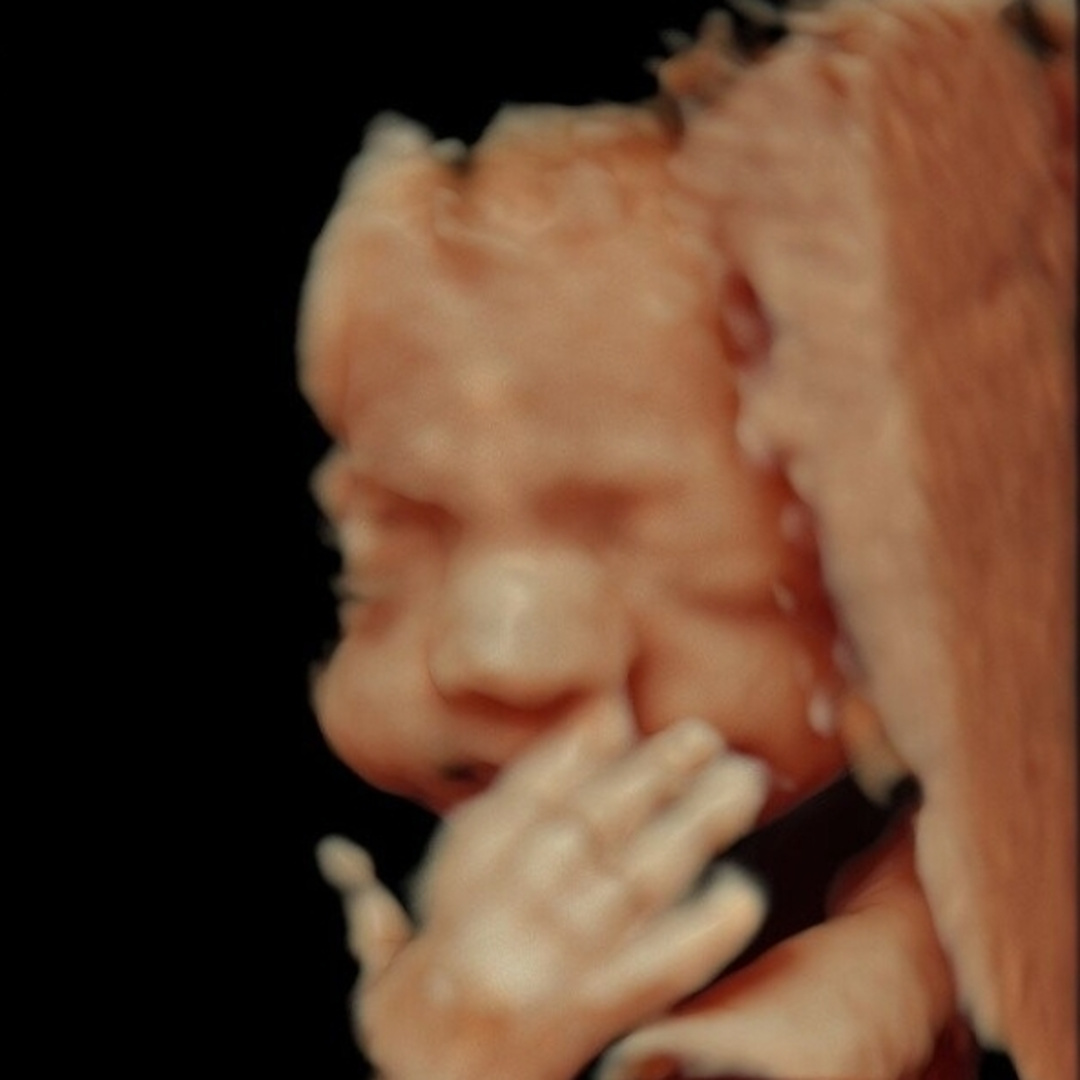Photo shared by Cheyenne for their Babylist baby registry.