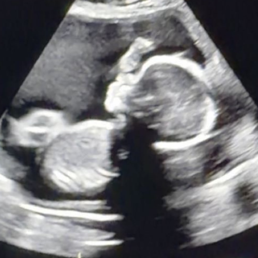 Photo shared by Cadie for their Babylist baby registry.