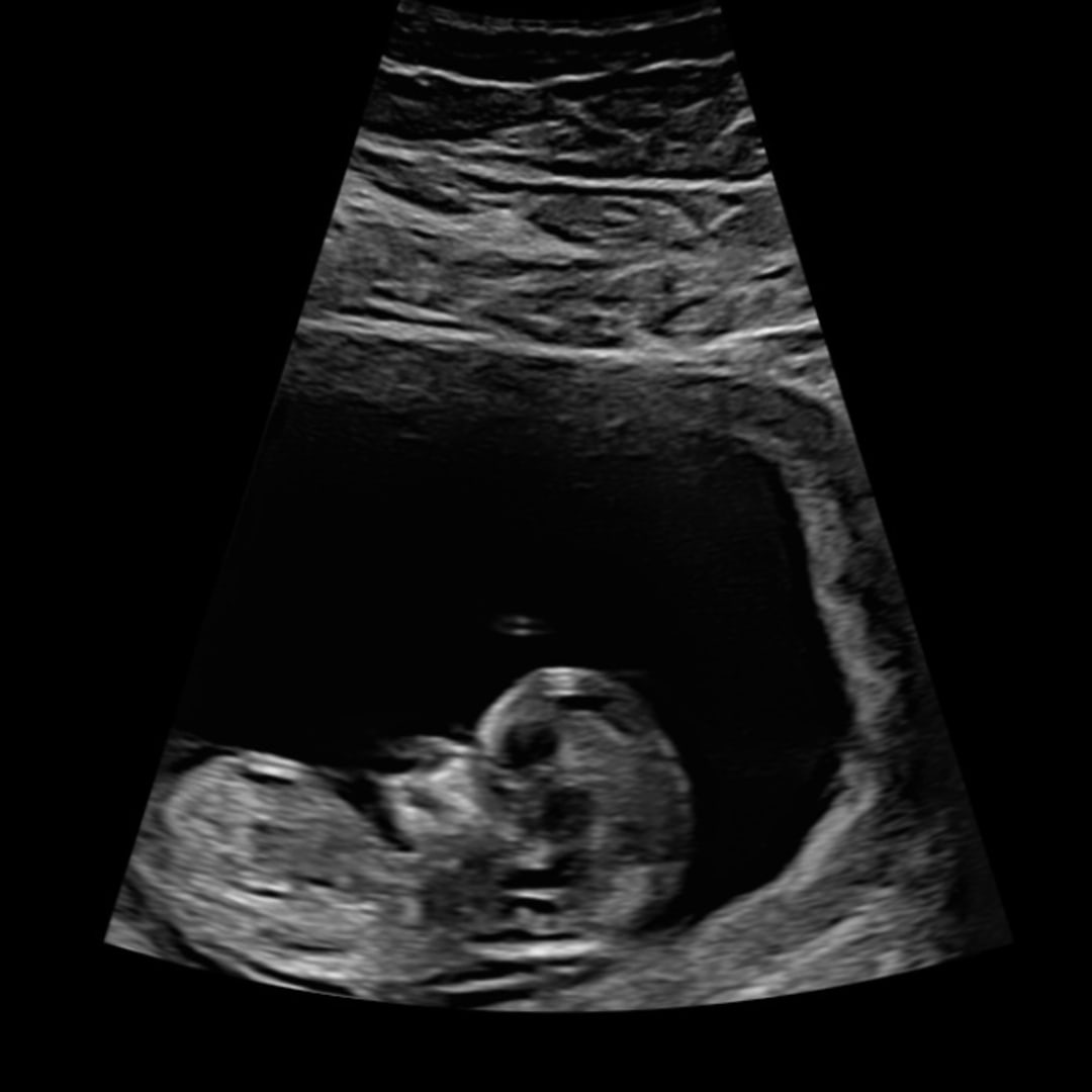 Photo shared by Emily for their Babylist baby registry.