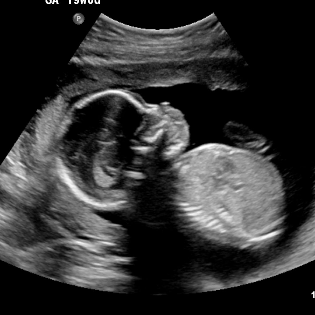 Photo shared by Ashley for their Babylist baby registry.