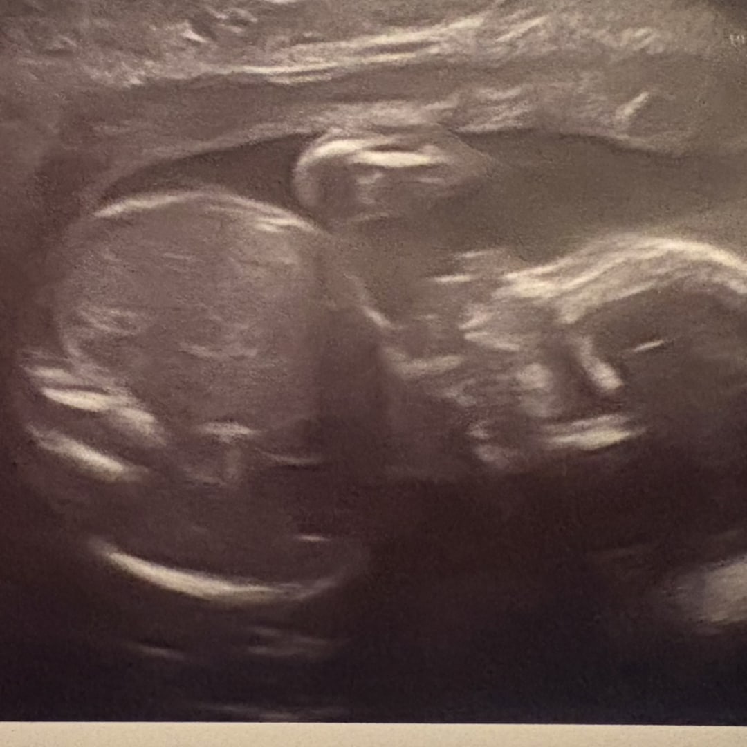 Photo shared by Amanda for their Babylist baby registry.