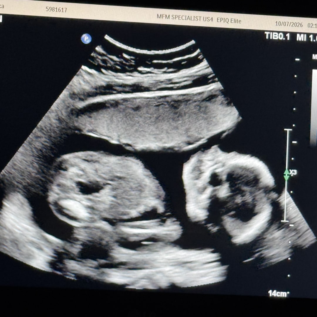 Photo shared by Erika for their Babylist baby registry.