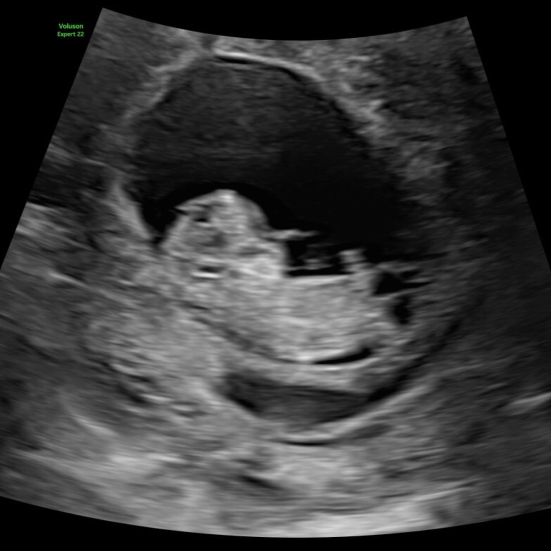 Photo shared by Samantha for their Babylist baby registry.