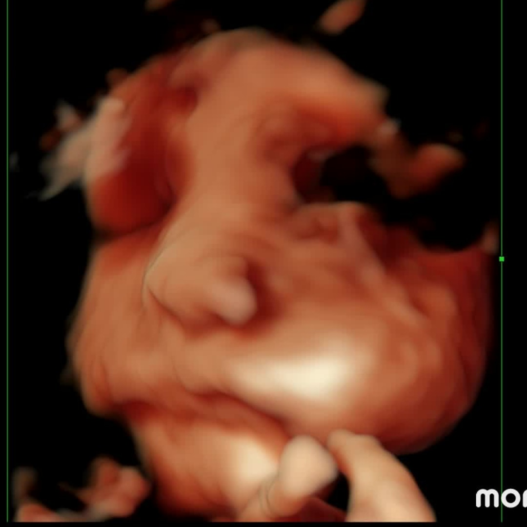 Photo shared by Melissa for their Babylist baby registry.
