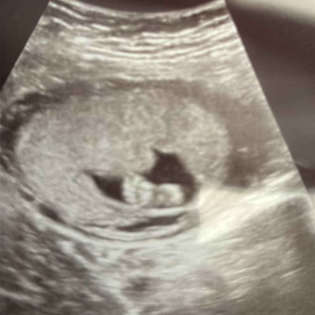 Photo shared by Constance for their Babylist baby registry.