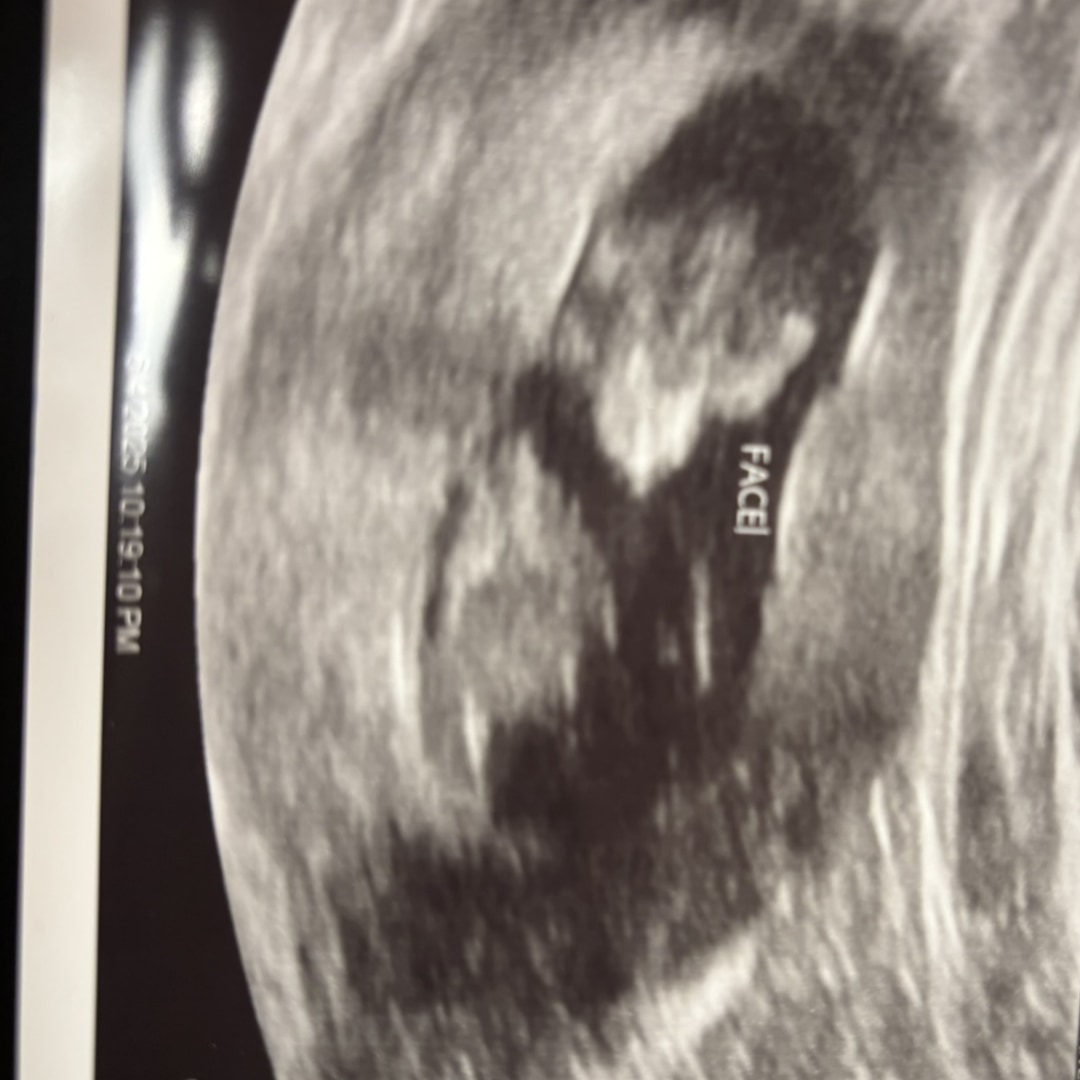 Photo shared by Maliyah for their Babylist baby registry.