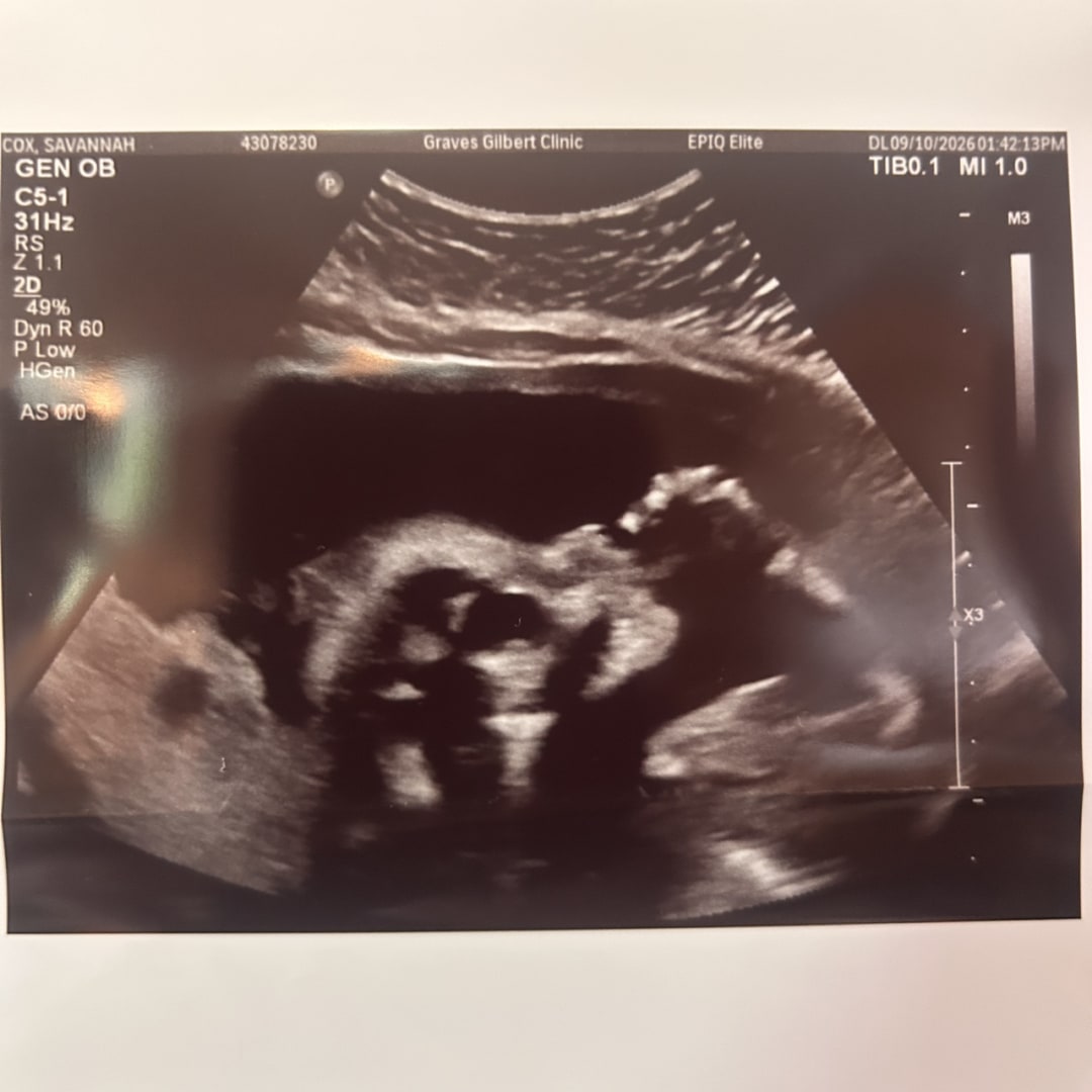 Photo shared by Savannah for their Babylist baby registry.