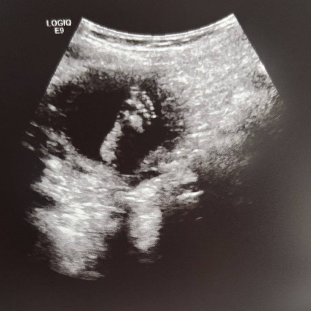 Photo shared by Faith for their Babylist baby registry.