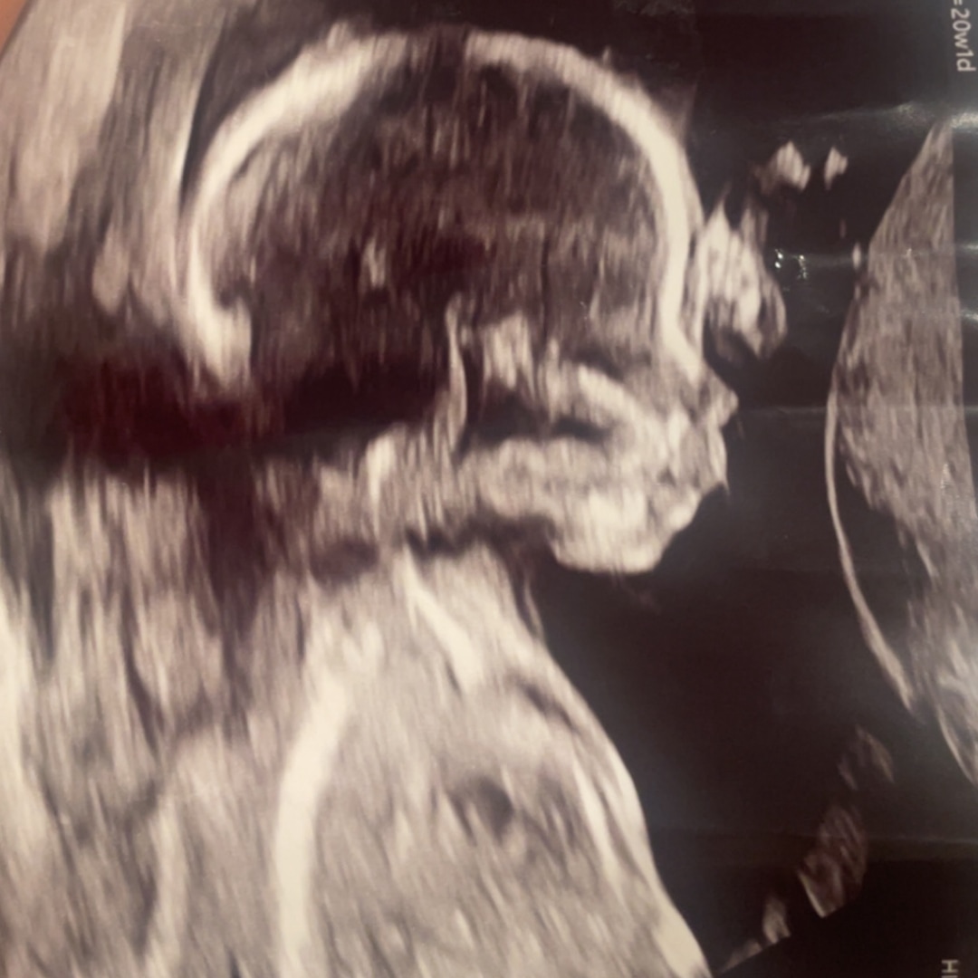 Photo shared by Lorena for their Babylist baby registry.