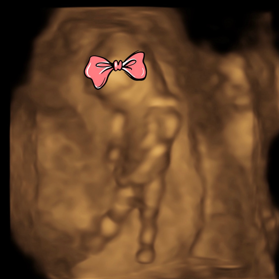 Photo shared by Lindsey for their Babylist baby registry.