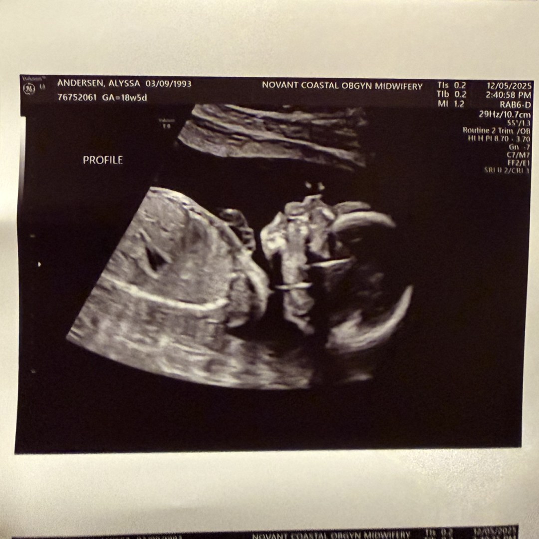 Photo shared by Alyssa for their Babylist baby registry.