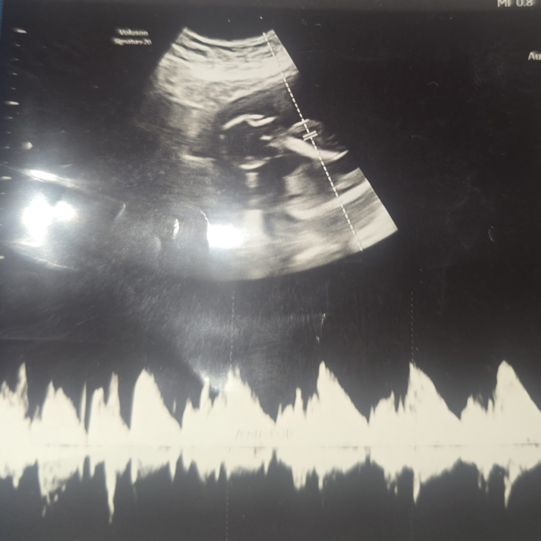 Photo shared by Ericka for their Babylist baby registry.