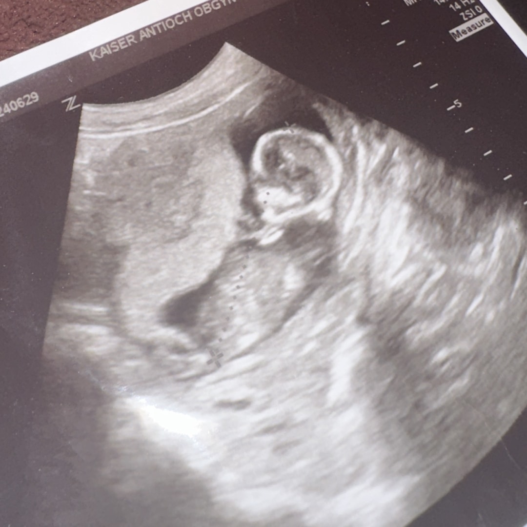 Photo shared by Izzabella for their Babylist baby registry.