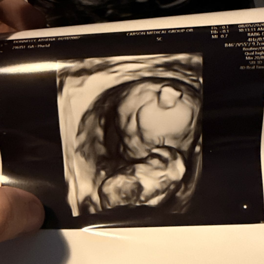 Photo shared by Athena for their Babylist baby registry.