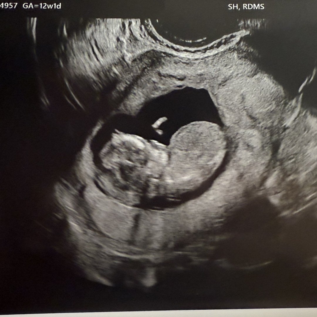 Photo shared by Fallon for their Babylist baby registry.