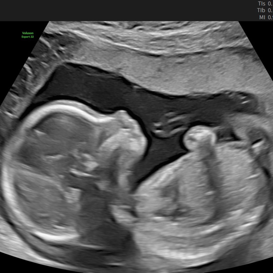 Photo shared by Melody for their Babylist baby registry.