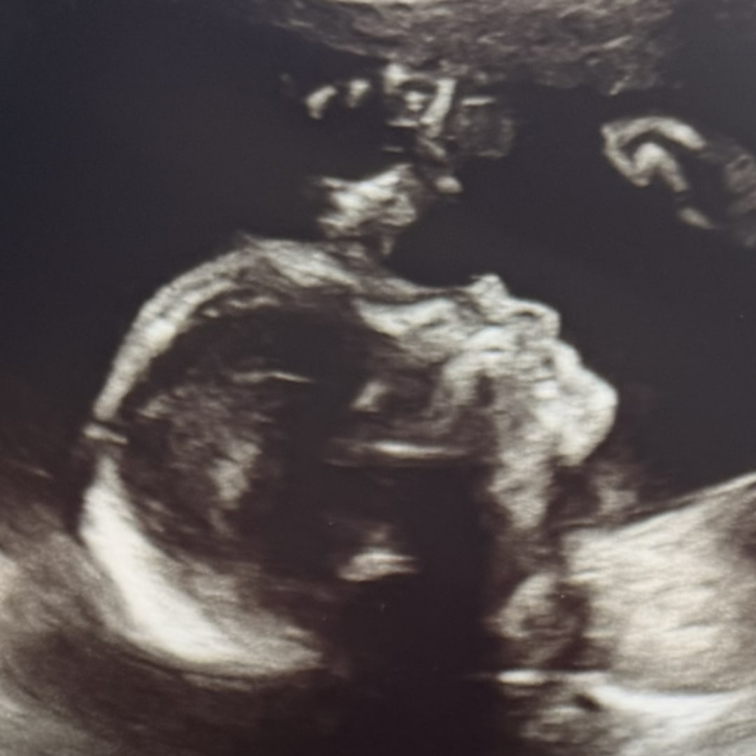 Photo shared by Aubrey for their Babylist baby registry.