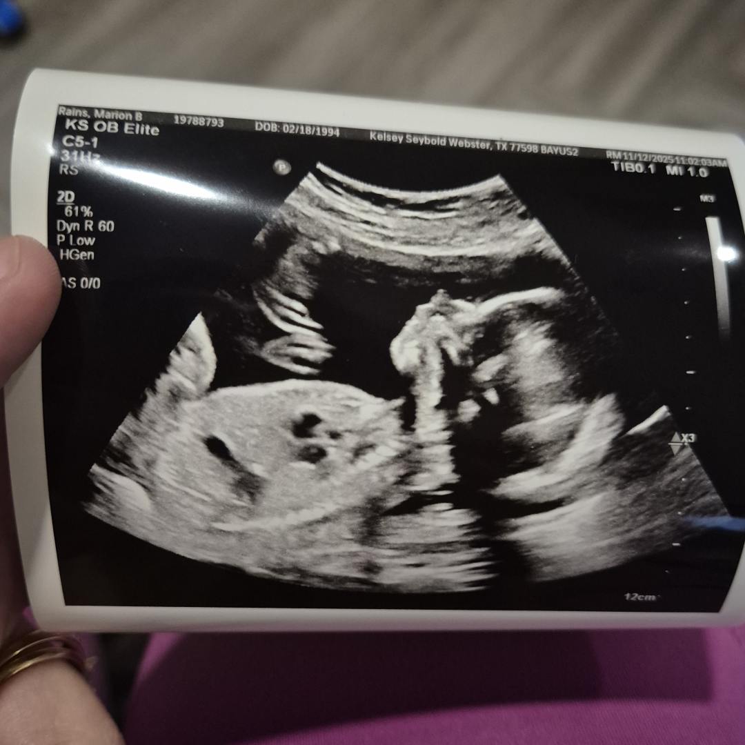 Photo shared by Marion for their Babylist baby registry.