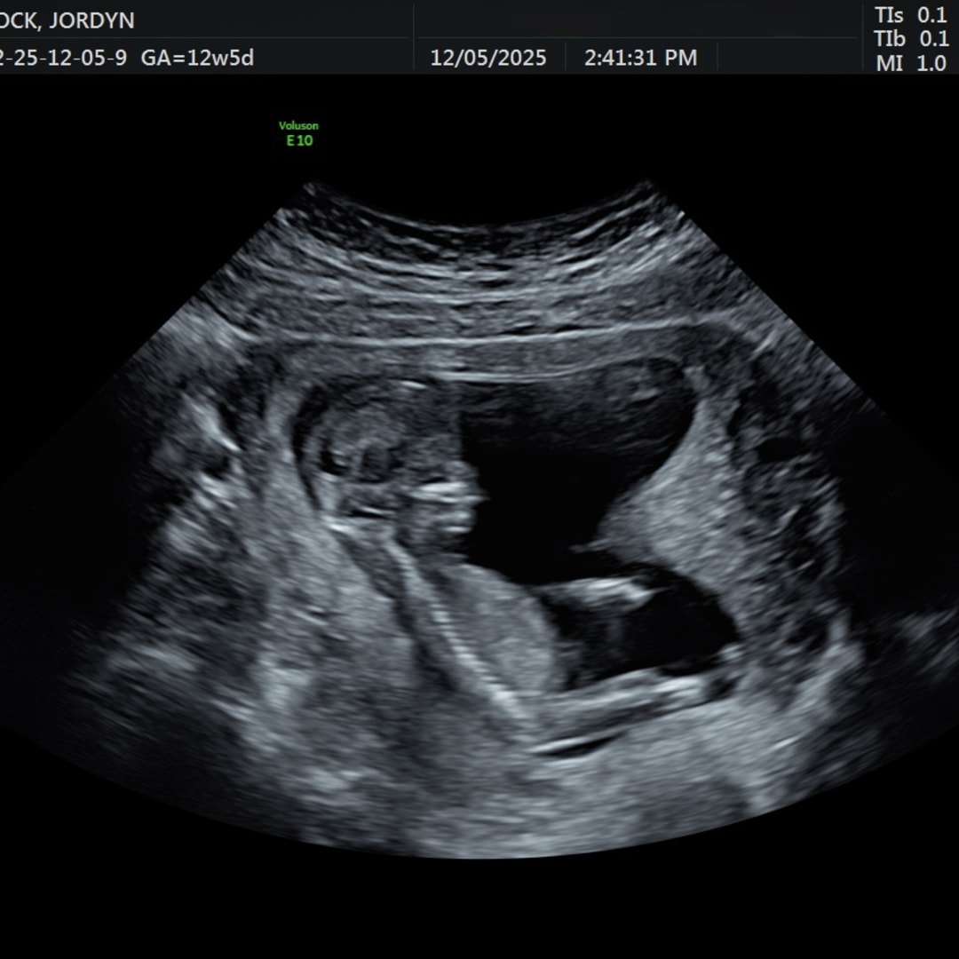 Photo shared by Jordyn for their Babylist baby registry.