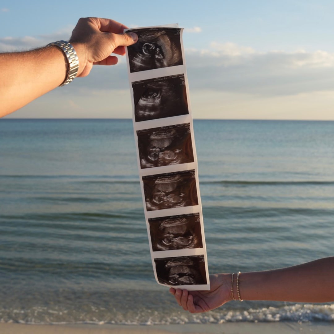 Photo shared by Hannah for their Babylist baby registry.