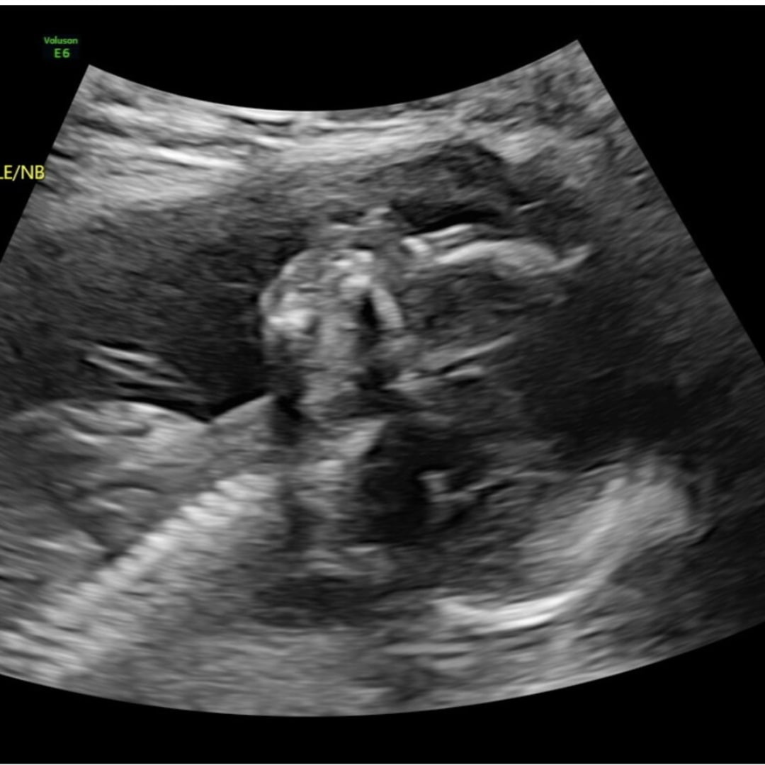 Photo shared by Dianette for their Babylist baby registry.