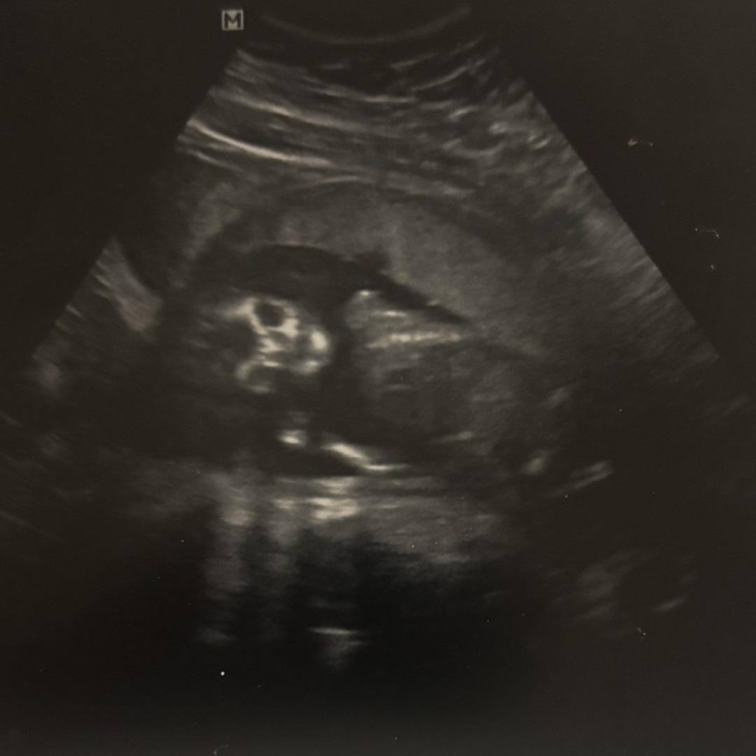 Photo shared by Hailey for their Babylist baby registry.