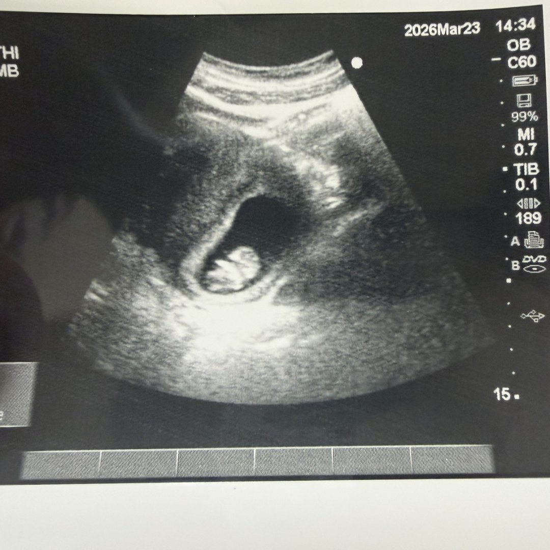 Photo shared by Collin & Alexa for their Babylist baby registry.