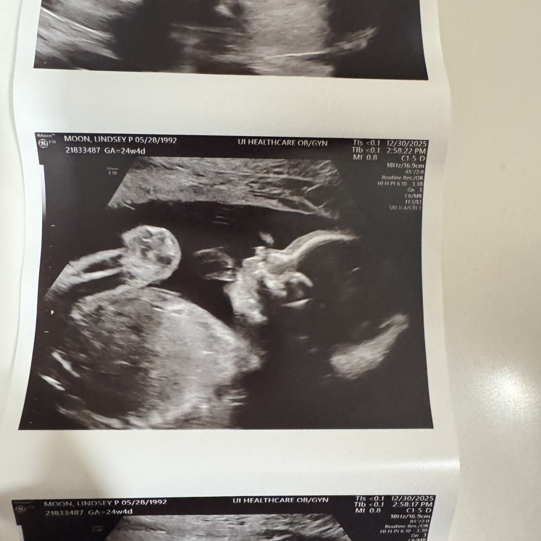 Photo shared by Lindsey for their Babylist baby registry.