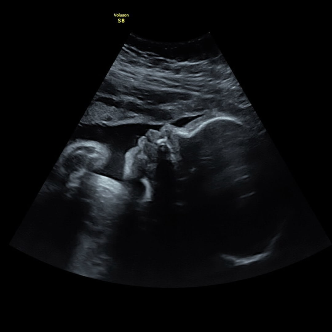 Photo shared by Janille Princess for their Babylist baby registry.