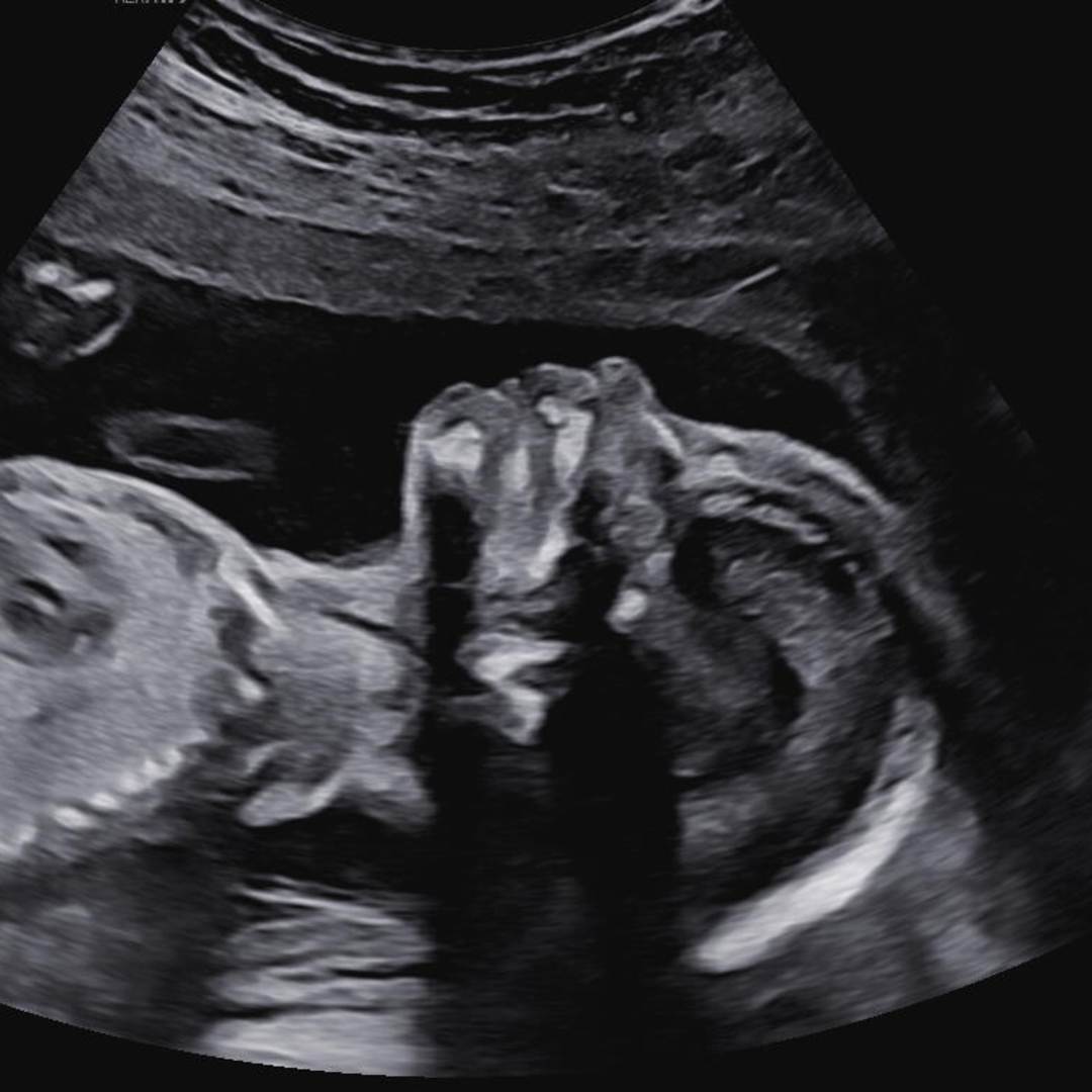 Photo shared by Grace for their Babylist baby registry.